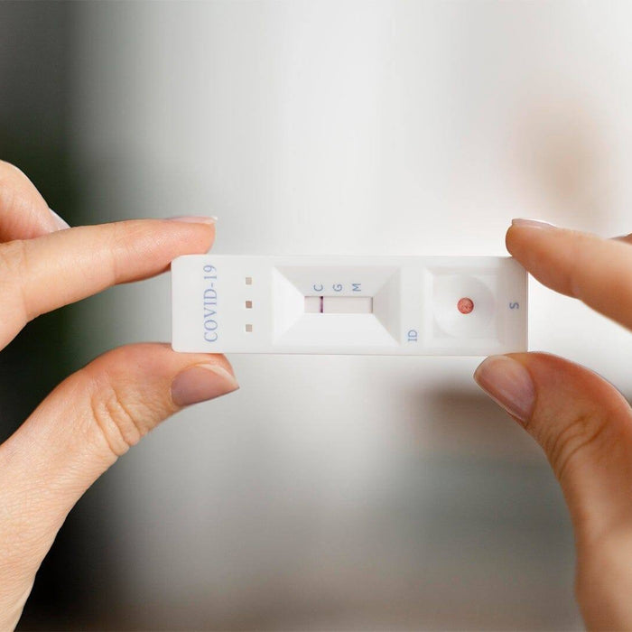 The Need for COVID-19 Testing: An Ongoing Assessment