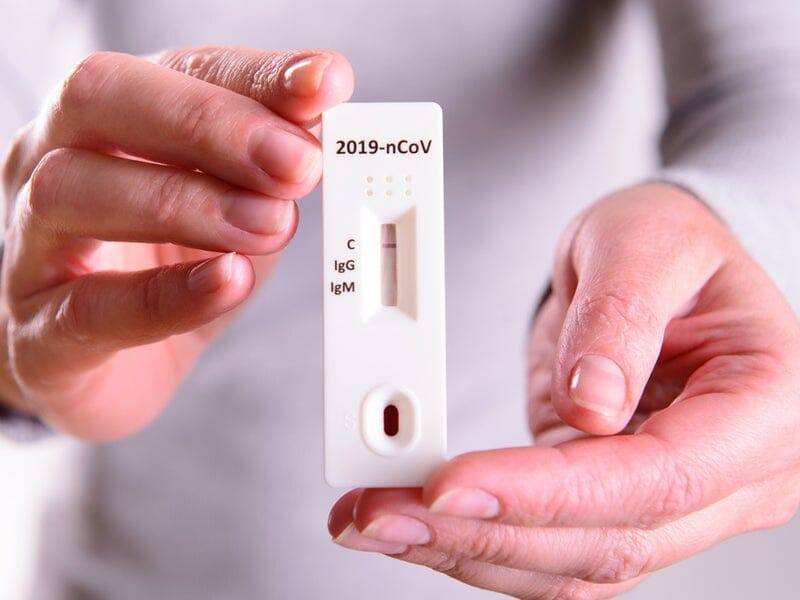 COVID-19 at-home kits are now available in Vizocare! Shop COVID-19 at-home kit from FDA approved brands to test yourself